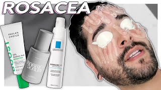 Dealing With amp Managing Rosacea  IPL Azelaic Acid barrier Repair ✖ James Welsh [upl. by Hieronymus761]