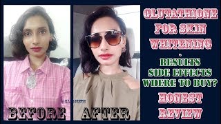 Glutathione Skin Whitening Tablets Results  Genuine Customer Review  SahiJeeth [upl. by Ydissac153]