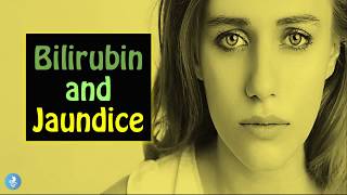 Bilirubin amp Jaundice Causes Symptoms and How to Prevent the YELLOW SKIN disease [upl. by Enilrek556]