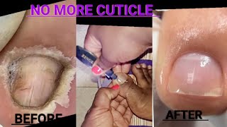 HOW TO REMOVE CUTICLES AT HOME WITHOUT BLEEDING  Beginner friendlycuticlecare pedicureathome [upl. by Ahsehat]