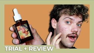 dr althea vitamin c boosting serum  trial  review [upl. by Clary]