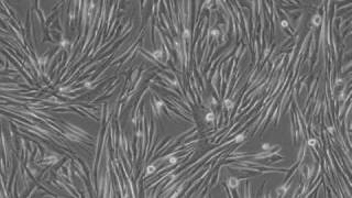 Differentiation of MM14 skeletal muscle cells [upl. by Forland]