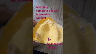 Maxillary impression ampmodelcompletedenture denture denturelife denturewearer prosthodontic [upl. by Oisacin]