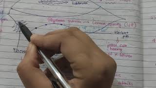 Trachoma diseases of conjunctivatheory notes with explanation AK KHURANA [upl. by Anahpets939]