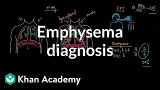 Emphysema diagnosis  Respiratory system diseases  NCLEXRN  Khan Academy [upl. by Nitz]