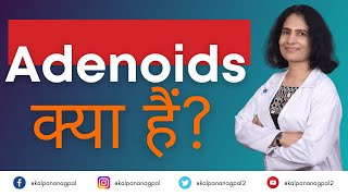 Adenoids क्या हैं ENT Surgeon I Dr Kalpana Nagpal [upl. by Rotciv273]