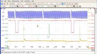 PicoScope 6 Introduction part 1 [upl. by Erv958]