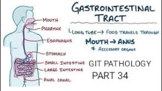 Intestine  Familial adenomatous polyposis git pathology intestines colon [upl. by Magdalena297]