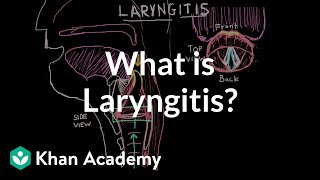 What is laryngitis   Respiratory system diseases  NCLEXRN  Khan Academy [upl. by Ellenrad205]