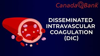 DIC Disseminated intravascular coagulation [upl. by Llevron]