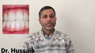 Benefits of clove By Dr Hussain [upl. by Anyala]