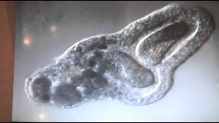 Amoeba eats two paramecia Amoebas lunch [upl. by Assillem893]