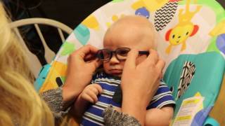 Baby with Albinism Sees Mom for First Time with Glasses [upl. by Aulea]