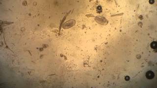 Active Strongyle Larvae in Horse Fecal [upl. by Nadbus172]