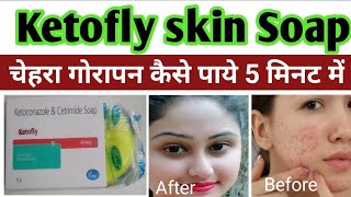 ketofly soap  ketoconazole soap  ketofly soap review in hindi  shorts  Mr health tips [upl. by Eliathan352]