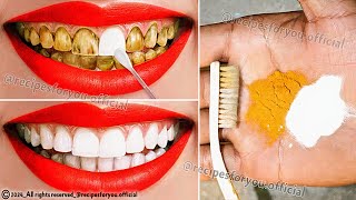 Natural mixtures for yellow teeth whitening at home in 2 minutes without a dentist a proven method💯 [upl. by Deibel]