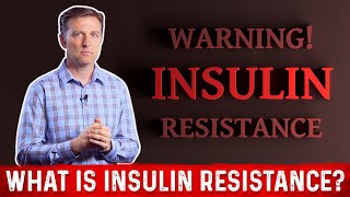 What Is Insulin Resistance – Dr Berg [upl. by Armanda]