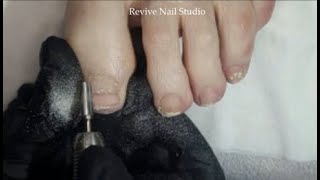 Polygel band removal after curve correction on big toe plus nail shaping and a polish application [upl. by Ahsiei]