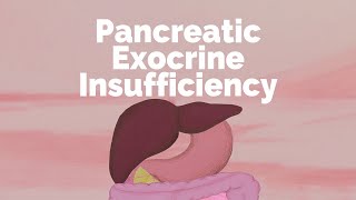 Pancreatic Exocrine Insufficiency  Gastrointestinal Society [upl. by Amsa]