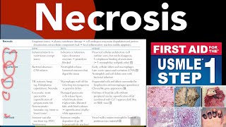 Necrosis Coaglative Liquefactive Caseous Fat Fibrinoid necrosis in HindiUrdu by first aid [upl. by Tarabar30]