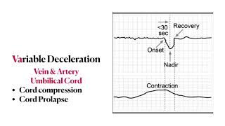 Fetal heart rate tracing  Mnemonics Concepts amp Management  High yield review [upl. by Namlaz]