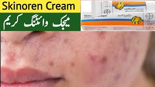 Skinoren creamBest and safe cream for Skin Brightening and skin Glow [upl. by Gaddi750]