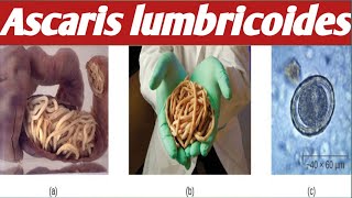 How To diagnose  Ascaris Lumbricoides [upl. by Nare]