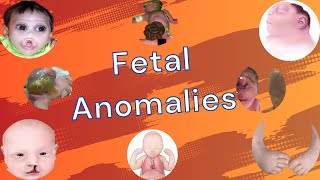 Fetal Anomalies [upl. by Gerstner466]