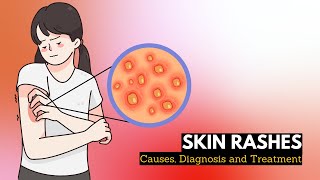 Skin Rash Causes Signs and Symptoms Diagnosis and Treatment [upl. by Waddle]