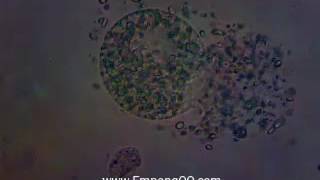 Fresh Water Oodinium cysts crack [upl. by Loferski]