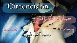 Circoncision  2025 عملية الختانة [upl. by Joshuah]