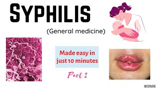 Syphilis Part  2  Made easy in 10 minutes  Medinare [upl. by Sloane]