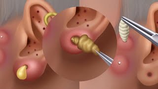 ASMR Ear cleaning and Earwax Removal  asmr animation  satisfying [upl. by Anelhtac460]