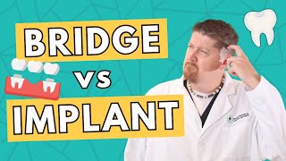 Dental Bridge vs Dental Implant  Costs Pros and Cons Which to Choose [upl. by Acirederf853]