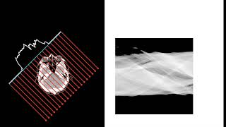 Formation of a CT sinogram [upl. by Gerg]