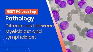 Pathology  Differences between Myeloblast and Lymphoblast [upl. by Ididn]