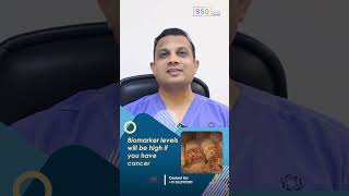 Biomarkers for Ovarian Cancer CA125 Vs HE4 Explained  Ovarian Cancer Diagnosis  Dr Nilesh [upl. by Enenej542]