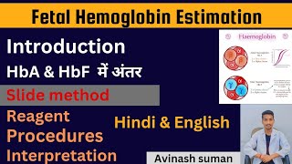 Fetal hemoglobin test in hindi ll Examination of fetal hemoglobin ll fetal hemoglobin test [upl. by Dewayne]