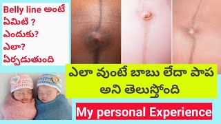 Linea Nigra during Pregnancy Belly line ద్వారా పుట్టేది బాబు పాప ఎలా తెలుస్తుందిTrue or False [upl. by Nomla]