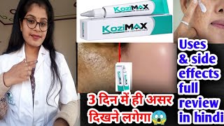 Kozimax skin lightening Cream honest review  Kozimax skin Cream benefits usesampside effects in hindi [upl. by Eilra]