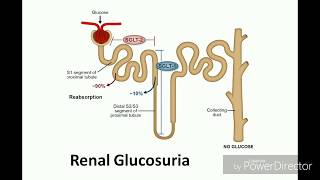 Renal glucosuria [upl. by Teena550]