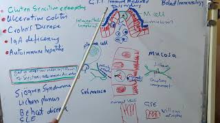 Gastrointestinal tract immune mediated disorders [upl. by Nbi]