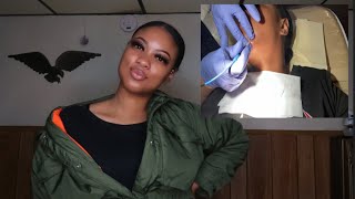 Electrolysis Hair Removal  UPDATE [upl. by Lilli]