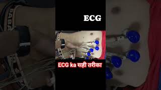 ECG in hindi  Ecg kaise karte h  how to take ECG  ECG krne ka sahi tarika how to attach ecg leads [upl. by Geri]