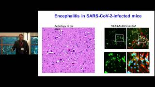 Evaluating Neuroinflammation During COVID and Other Neurotropic Viral Diseases Using MILLIPLEX® Kits [upl. by Claudina]