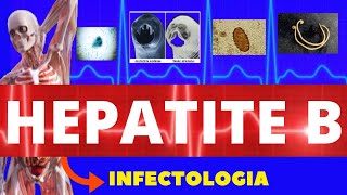 HEPATITE B  CARACTERÍSTICAS SINTOMAS DIAGNÓSTICO E TRATAMENTO  INFECTOLOGIA [upl. by Snow]