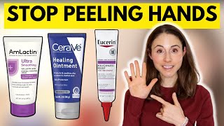 How to STOP SKIN PEELING ON THE HANDS amp FEET 🤔 Dermatologist DrDrayzday [upl. by Zacharias556]