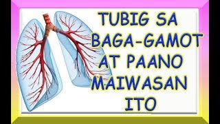 TUBIG SA BAGA PULMONARY EDEMA  GAMOT AT PAANO MAIWASAN [upl. by Ennaej786]