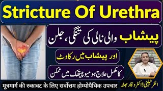 Stricture Of Urethra پیشاب کی نالی تنگ ہونا मूत्रमार्ग की सख्ती Homeopathic Treatment by In Urdu [upl. by Claudianus282]