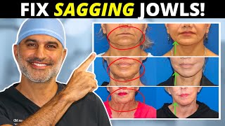 Sagging Jowls 101 How they form and what to do about them tighten and eliminate [upl. by Llerad]